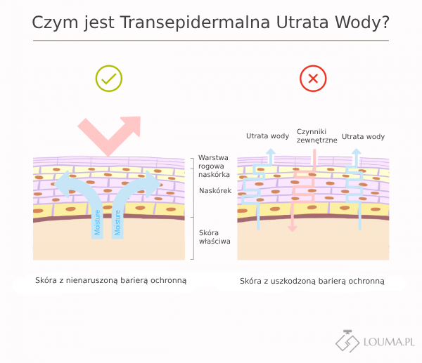 Transepidermalna Utrata Wody