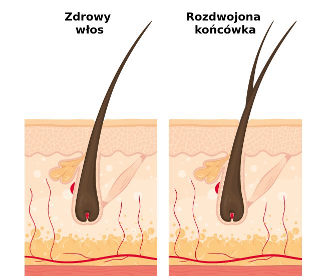 rozdwojone końcówki