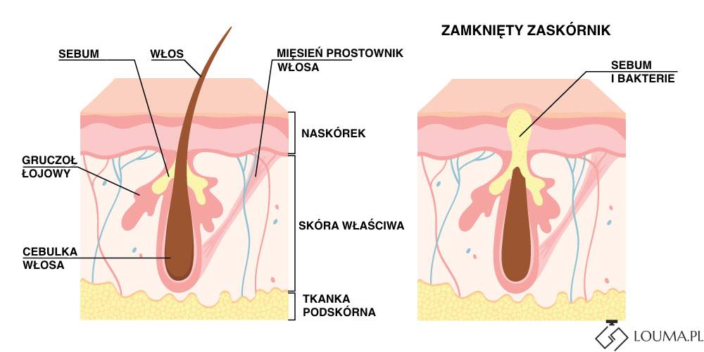 zaskórniki