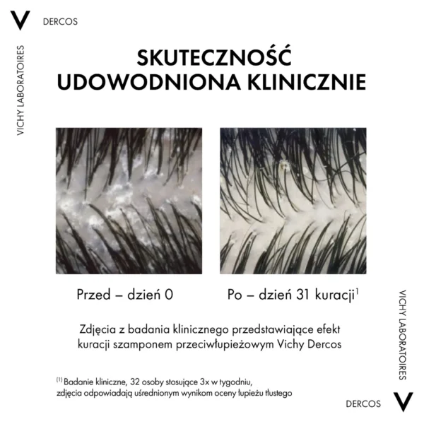 Vichy Dercos szampon przeciwłupieżowy do włosów suchych, 390 ml - obrazek 5