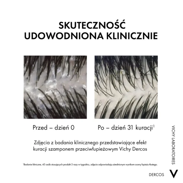 VICHY DERCOS Szampon Przeciwłupieżowy z odżywką 2w1, 390ml - obrazek 5