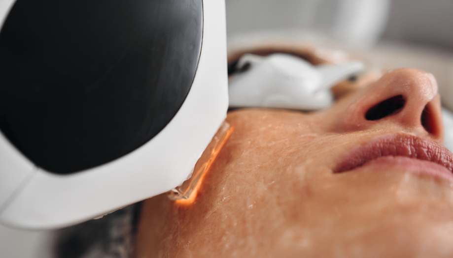 pryszcze podskórne leczenie laserowe